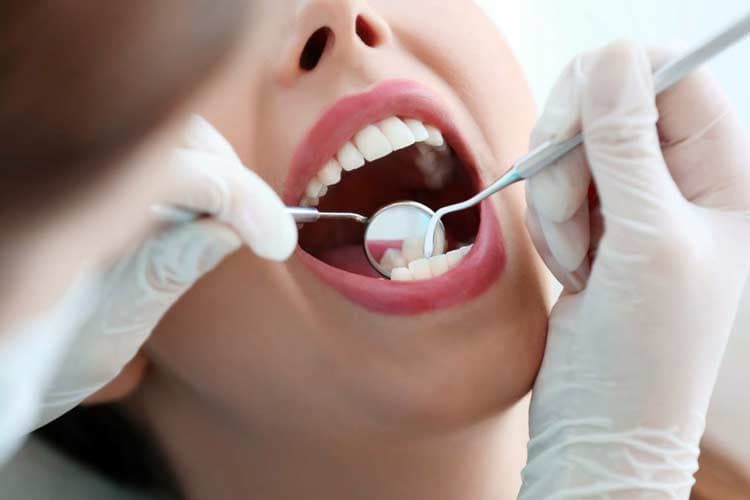 Cara Efektif Mencegah Gigi Berlubang